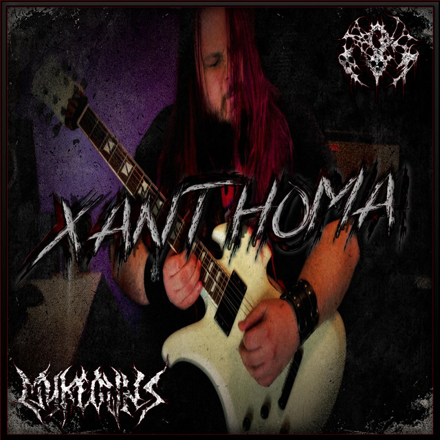 Xanthoma